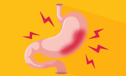 Terganggunya Lambung Mengakibatkan Sakit Maag Perih